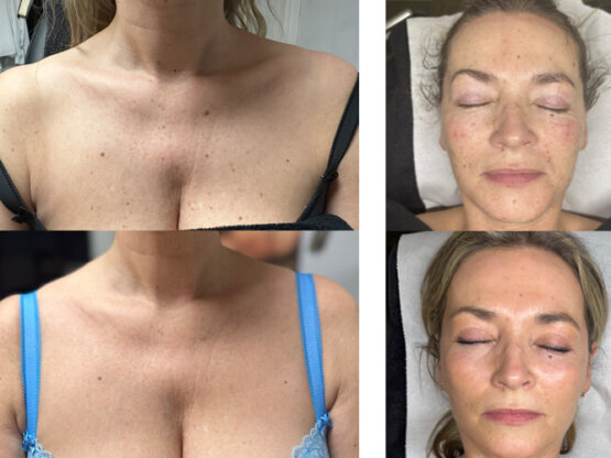 Ikke-navngivet-11.jpg bb