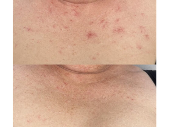 Ikke-navngivet-11.jpg decol