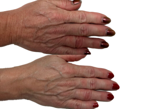 Ikke-navngivet-11.jpg hondna