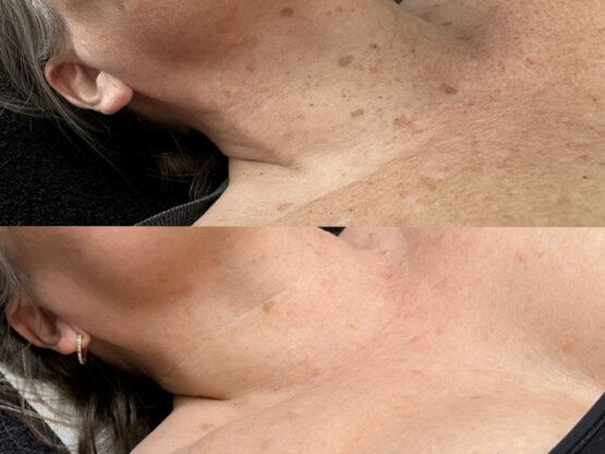 Ikke-navngivet-11.jpg irdi dekolle