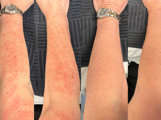 Ikke-navngivet-11.jpg jkjk