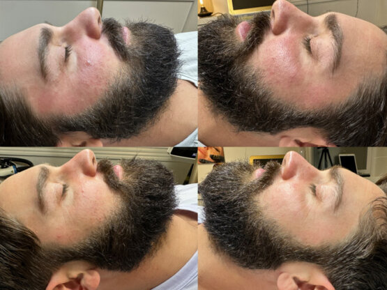 Ikke-navngivet-11.jpg lu2