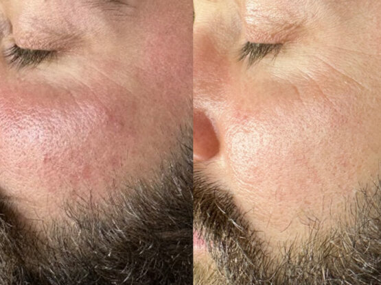 Ikke-navngivet-11.jpg lu7tg