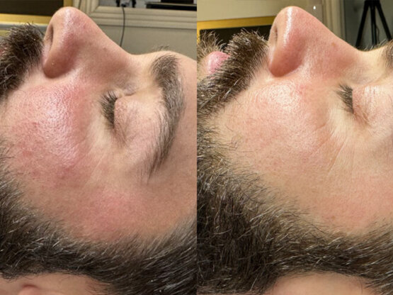 Ikke-navngivet-11.jpg lubb