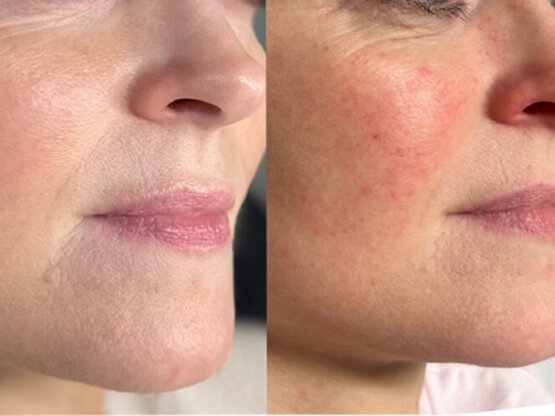 Ikke-navngivet-11.jpg ma