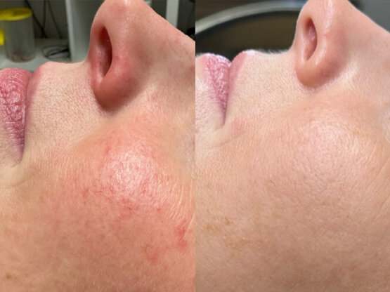 Ikke-navngivet-11.jpg ma ro