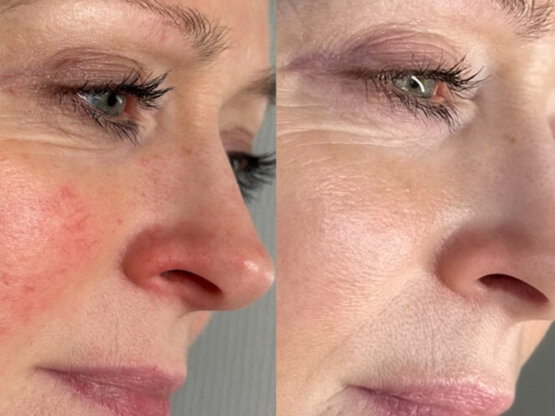 Ikke-navngivet-11.jpg ma yty