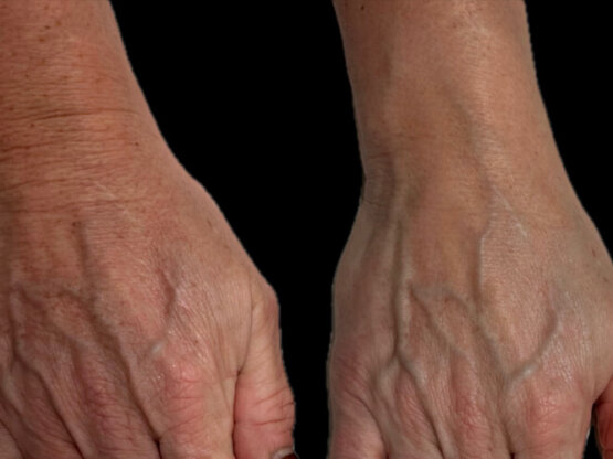 Ikke-navngivet-11.jpg nad 2 ipl 2