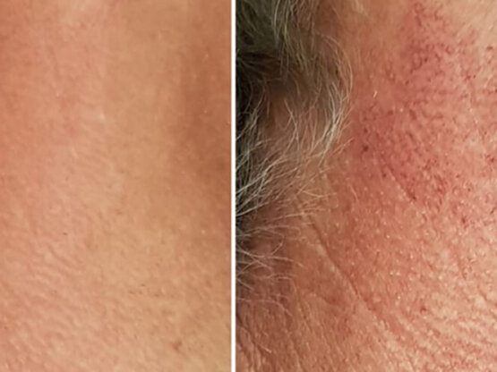 Ikke-navngivet-11.jpg poik 3 ipl