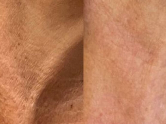 Ikke-navngivet-11.jpg poik 4