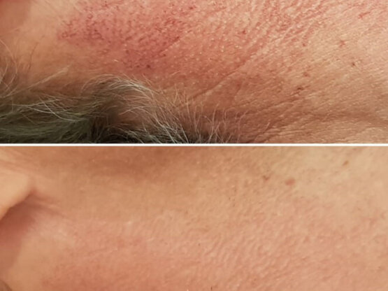 Ikke-navngivet-11.jpg poik ipl 3